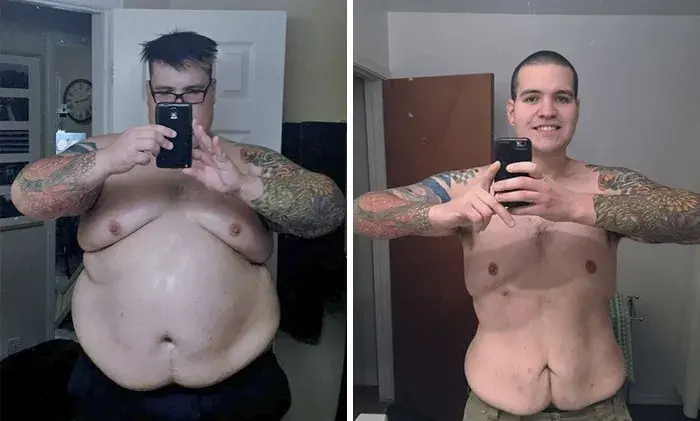 Before and after weight loss