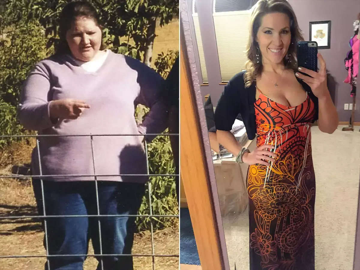 Before and after weight loss